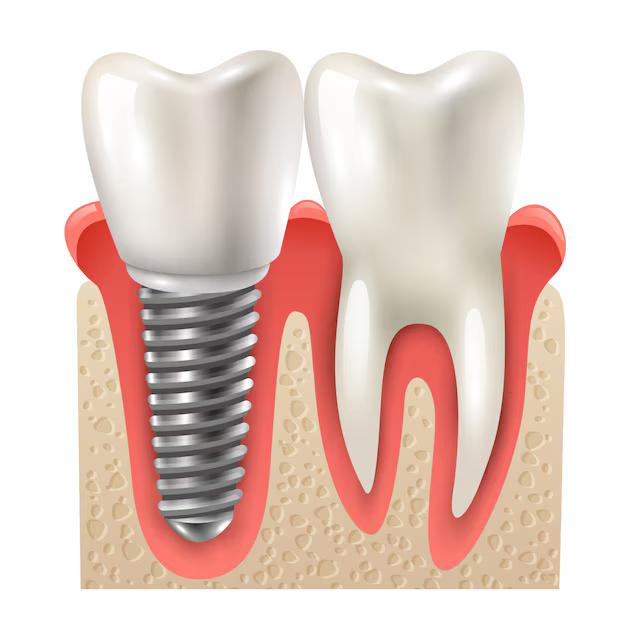 prosthodontic image2