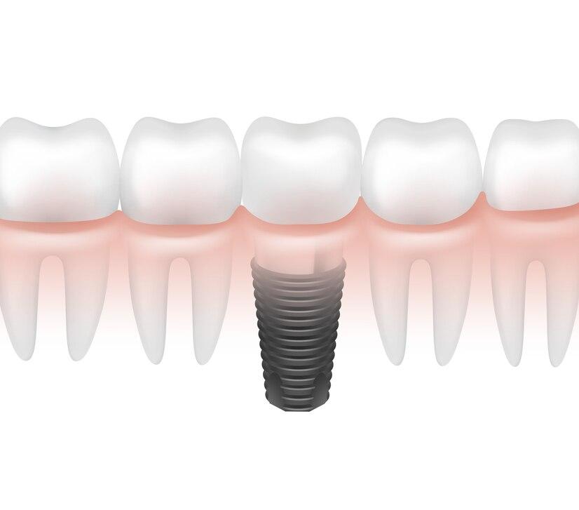 prosthodontics image